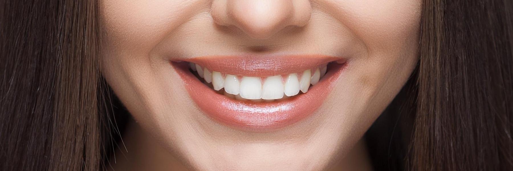 Lad's' teeth after getting dental implants from 50th and France Dental Care