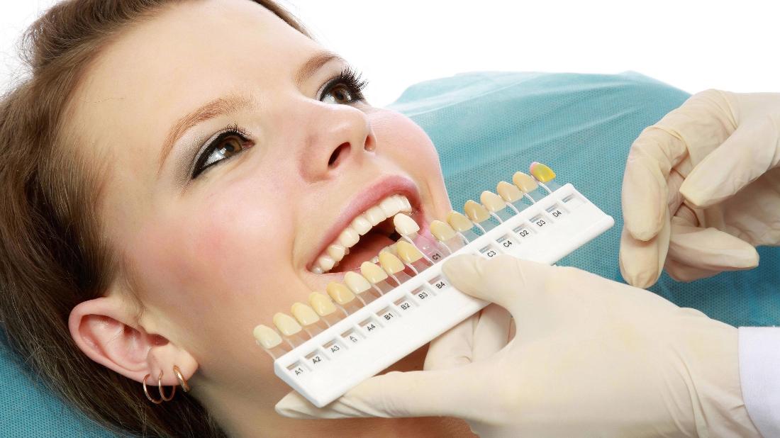 Best Dentist Edina MN Your Teeth Whitening Expectations