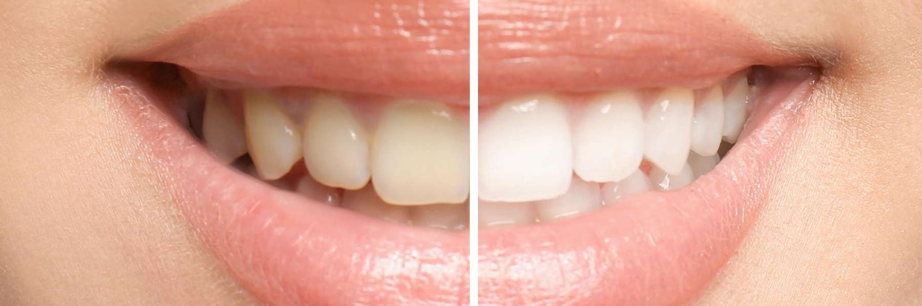 periodontal treatment Edina, MN