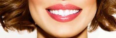 Patients teeth after getting veneers in Edina, MN