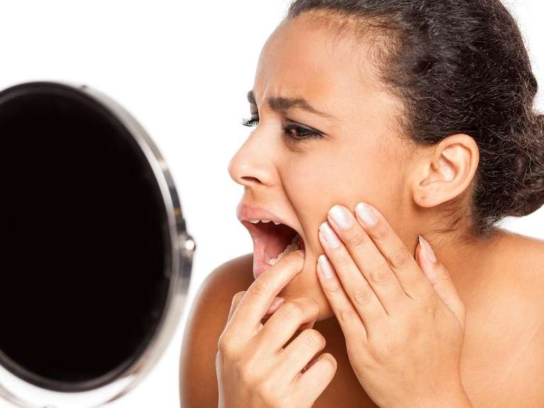  A woman with Gum Disease in Edina, MN