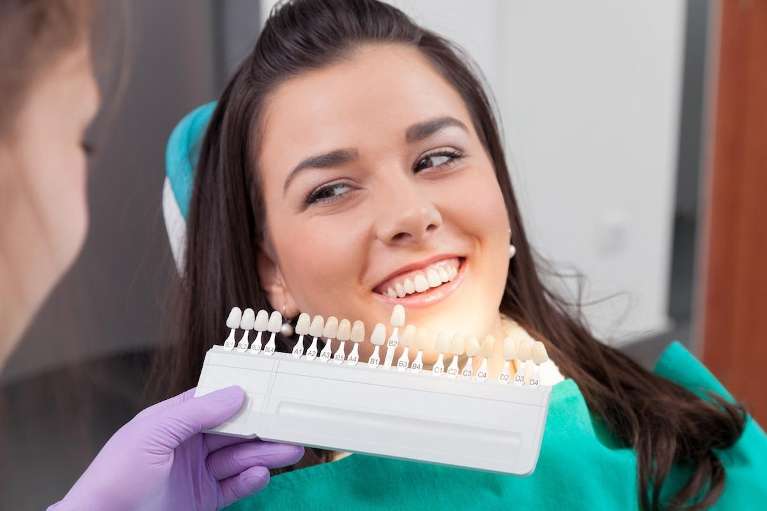 teeth color shade chart