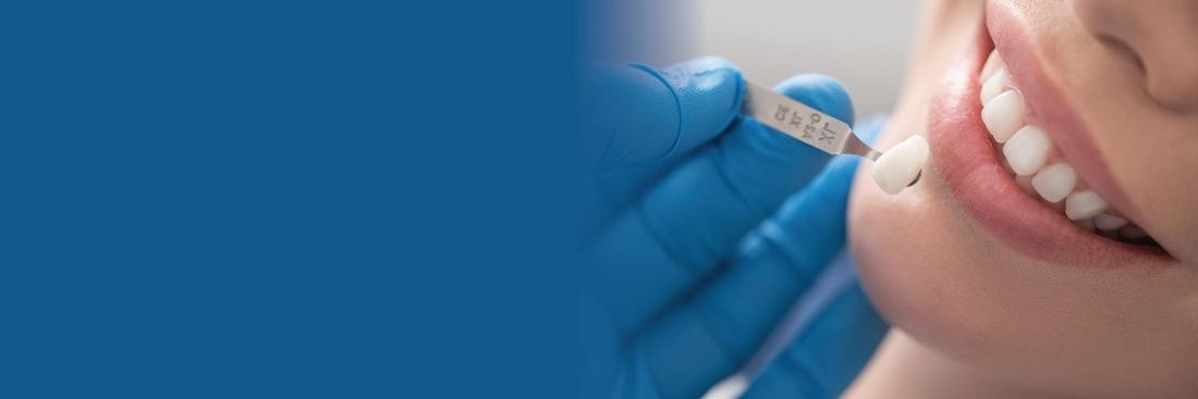 Patient smiling while getting dental veneers in Edina, MN