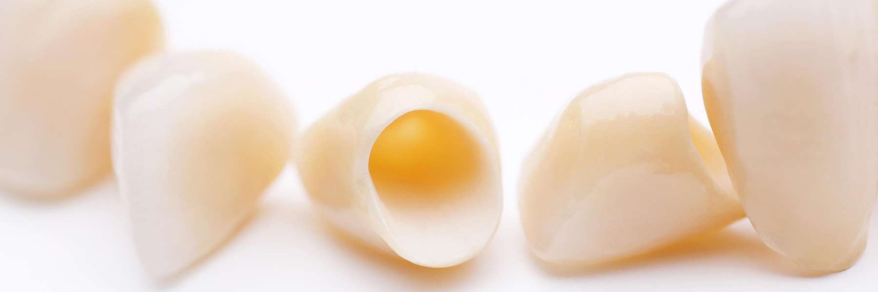 Picture of dental crowns in Edina, MN